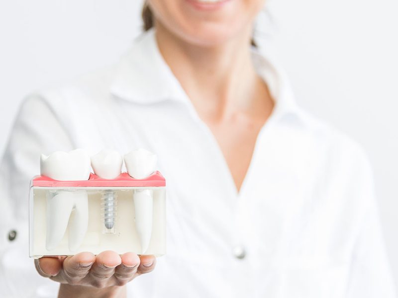 Tipos de implantes dentales en Clínica Dental Marta Escribano